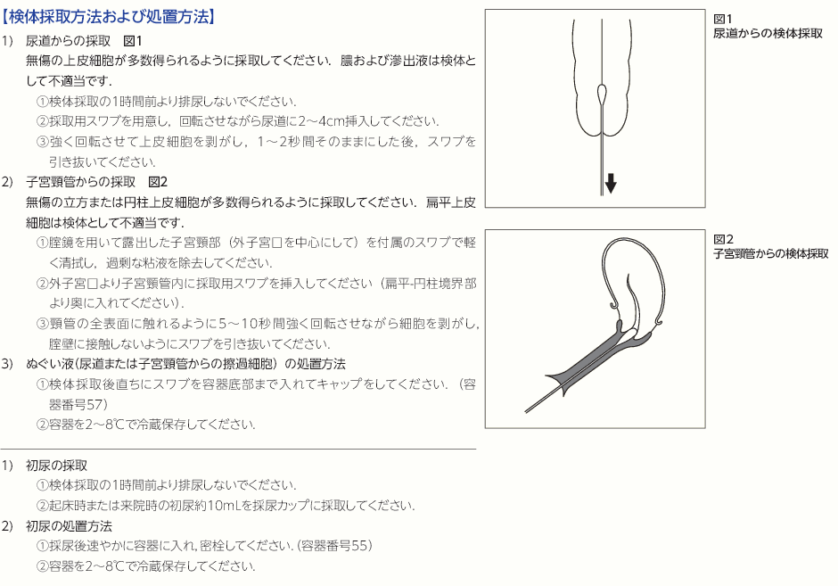 STDマイコプラズマ同定検査の留意点